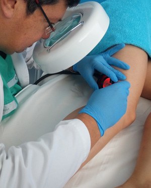 Dr. Arturo performing micro slerotherapy