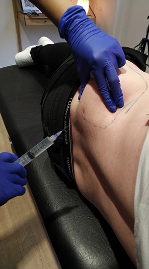 Body flank - Aqualyx